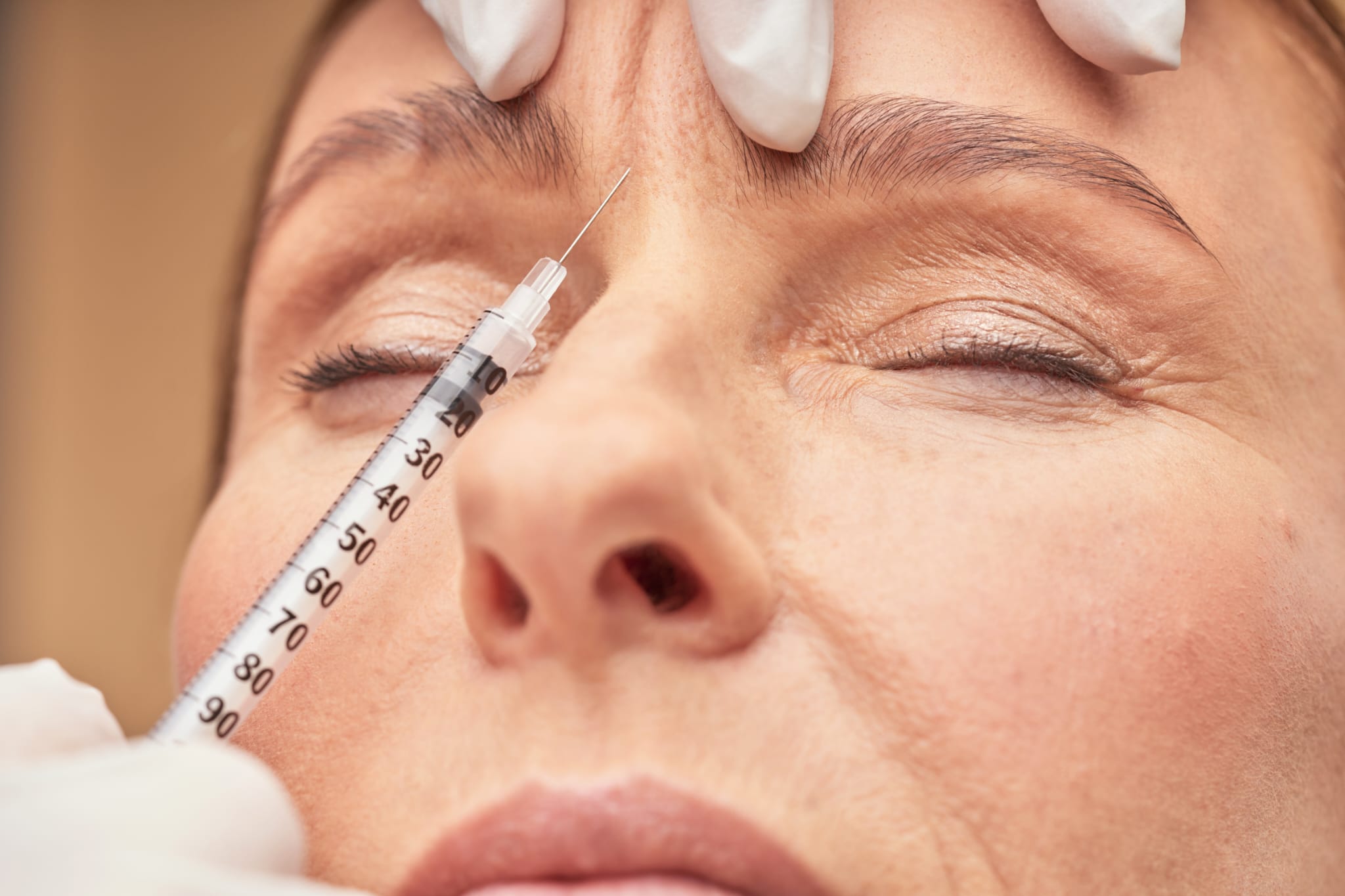 Frown Lines Botox Thornhill