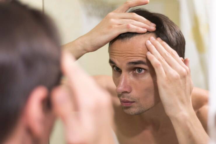 best hair loss treatment