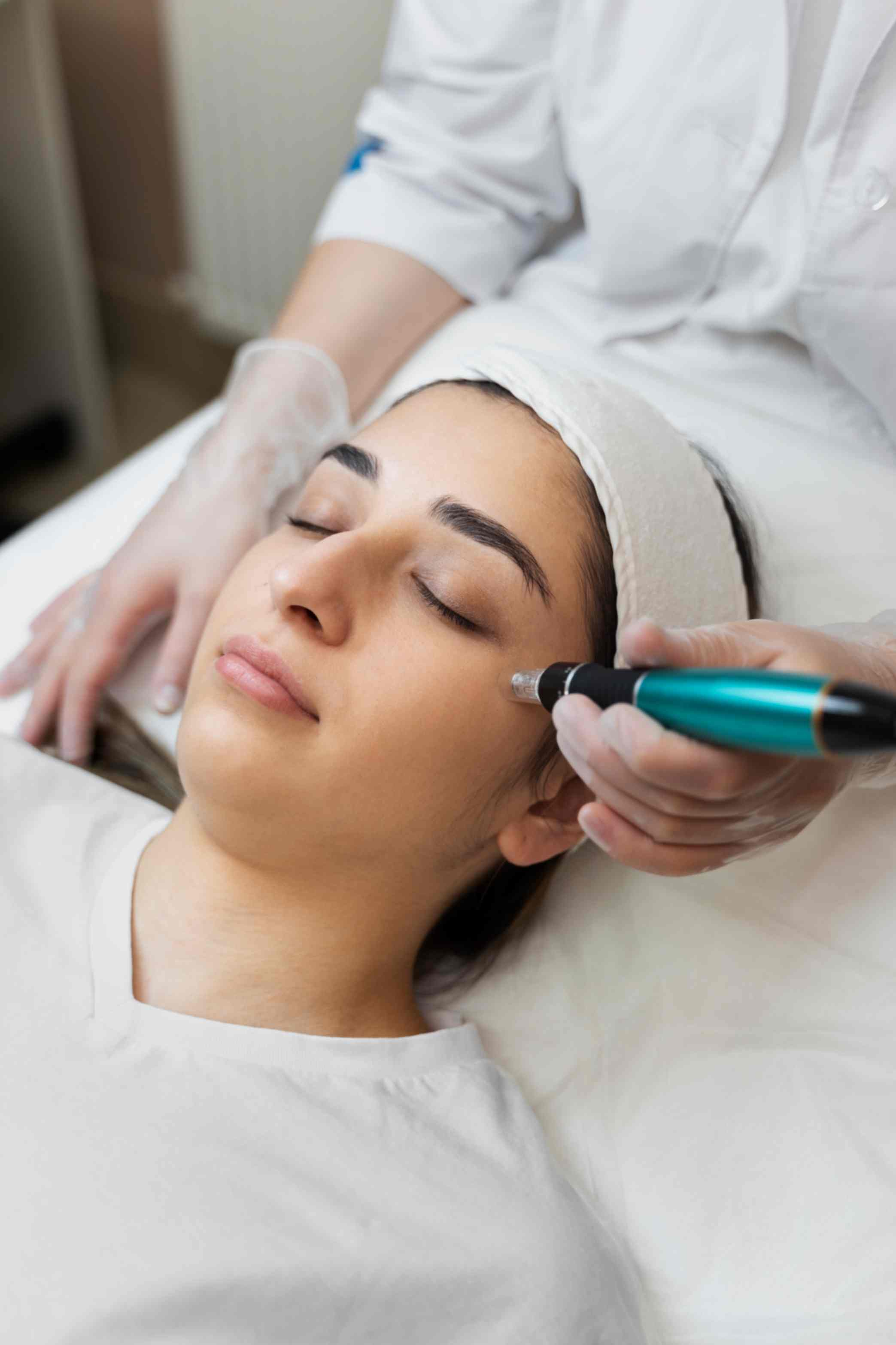 What Is Microneedling