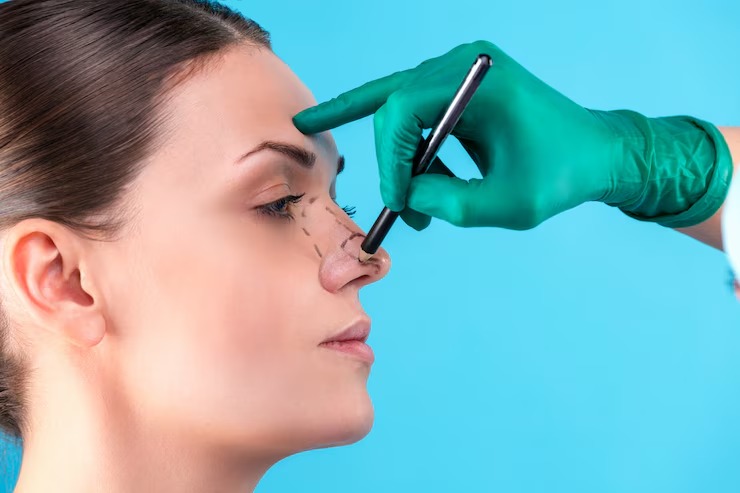 Nose Deformity Treatment Options 